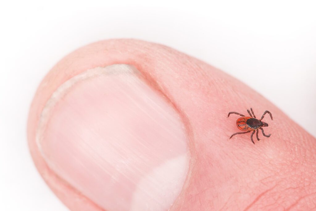 Tick Safety and Lyme Disease Prevention