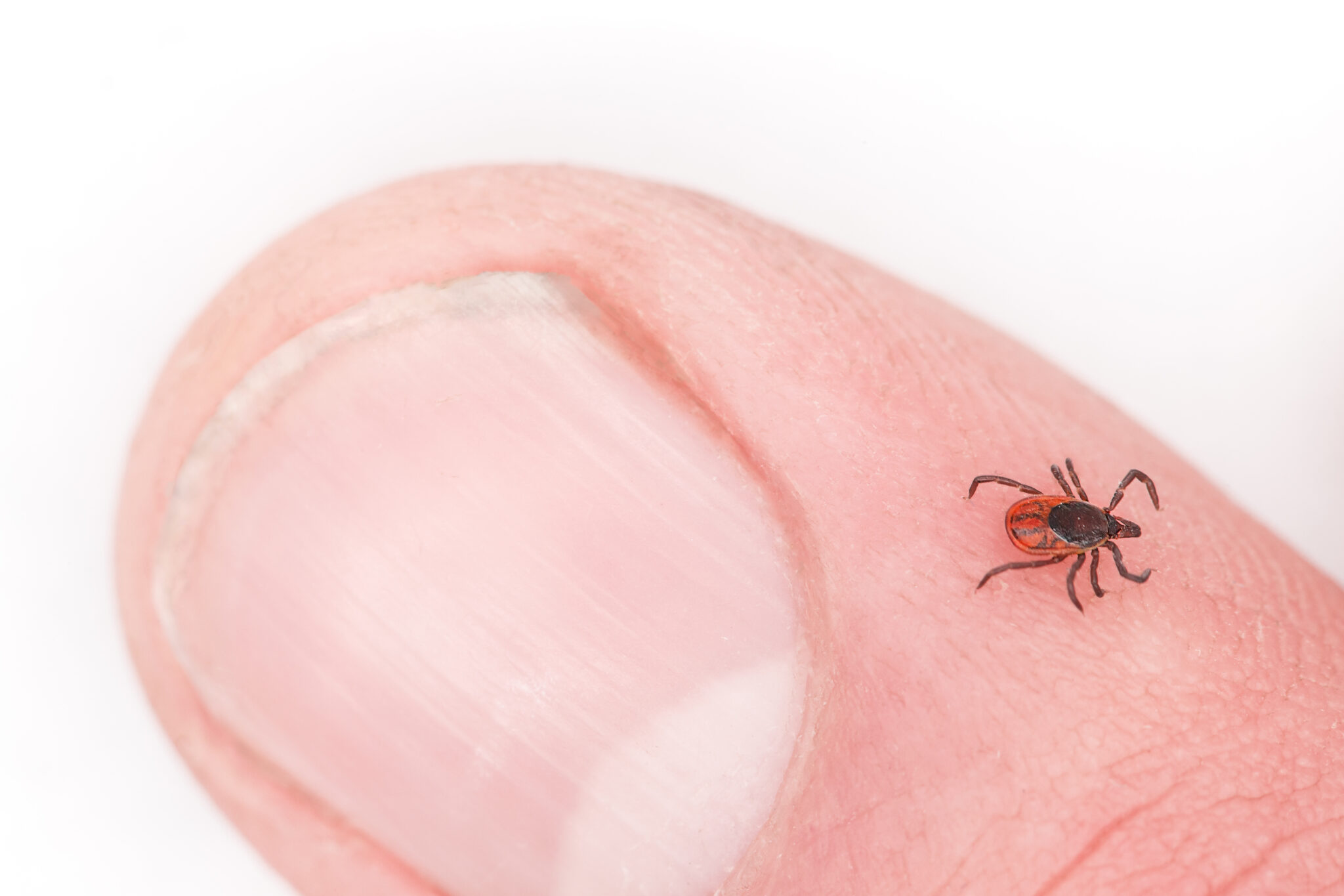 Tick Safety and Lyme Disease Prevention